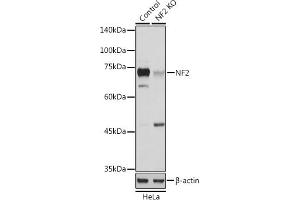 Western blot analysis of extracts from normal (control) and NF2 Rabbit pAb knockout (KO) HeLa cells, using NF2 Rabbit pAb antibody (ABIN6128276, ABIN6144549, ABIN6144552 and ABIN6217696) at 1:1000 dilution. (Merlin antibody  (AA 477-576))
