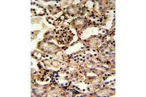 Formalin-fixed and paraffin-embedded kidney tissue reacted with GS Antibody (Center), which was peroxidase-conjugated to the secondary antibody, followed by DAB staining. (GMP Synthase antibody  (AA 296-325))