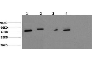 Western Blot analysis of Jurkat, Hela, Mouse brain, Rat brain using gamma Tubulin Monoclonal Antibody at dilution of 1:1000. (TUBG1 antibody)