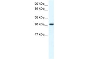 Western Blotting (WB) image for anti-Four and A Half LIM Domains 1 (FHL1) antibody (ABIN2460931)