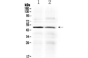 Western blot analysis of HtrA3 using anti- HtrA3 antibody .