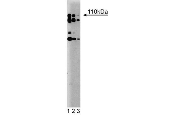 PIK3CD Antikörper  (AA 73-90)
