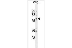 Western blot analysis in WiDr cell line lysates (35ug/lane). (BCMO1 antibody  (AA 263-292))