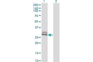 Western Blot analysis of SPINT2 expression in transfected 293T cell line by SPINT2 monoclonal antibody (M01), clone 2D1. (SPINT2 antibody  (AA 1-253))