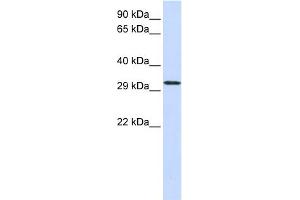 C21orf2 antibody  (N-Term)