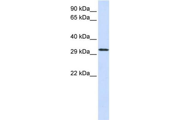C21orf2 antibody  (N-Term)