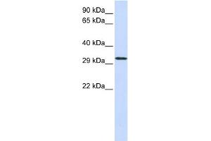 WB Suggested Anti-C21orf2 Antibody Titration:  0. (C21orf2 antibody  (N-Term))