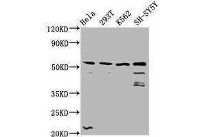 Western Blot Positive WB detected in: Hela whole cell lysate, 293T whole cell lysate, K562 whole cell lysate, SH-SY5Y whole cell lysate All lanes: RUFY3 antibody at 3. (RUFY3 antibody  (AA 243-352))