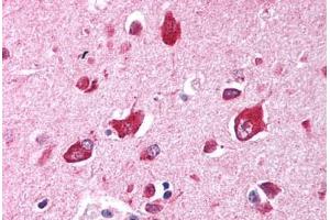 Human Brain, Cortex (formalin-fixed, paraffin-embedded) stained with TRIM35 antibody ABIN213723 at 2. (TRIM35 antibody  (AA 145-194))