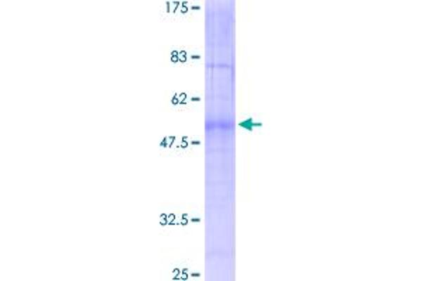 MC1 Receptor Protein (AA 1-317) (GST tag)