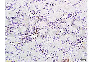 Formalin-fixed and paraffin embedded rat brain tissue labeled with Anti phospho-MAP3K9+MAP3K10(Thr312+Thr266) Polyclonal Antibody, Unconjugated (ABIN872294) at 1:200 followed by conjugation to the secondary antibody and DAB staining (MAP3K9 antibody  (pThr312))