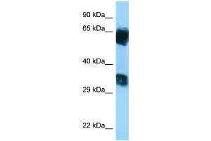 WB Suggested Anti-Mgat5b Antibody   Titration: 1. (MGAT5B antibody  (C-Term))