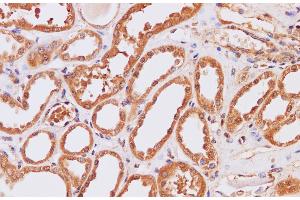 Immunohistochemistry of paraffin-embedded Human kidney using ITPKB Polyclonal Antibody at dilution of 1:200 (ITPKB antibody)