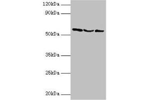 Western blot All lanes: USP14 antibody at 2 μg/mL Lane 1: Hela whole cell lysate Lane 2: 293T whole cell lysate Lane 3: NIH/3T3 whole cell lysate Secondary Goat polyclonal to rabbit IgG at 1/10000 dilution Predicted band size: 57, 53, 55 kDa Observed band size: 57 kDa (USP14 antibody  (C-Term))