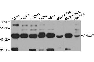 Western blot analysis of extract of various cells, using ANXA7 antibody. (Annexin VII antibody)