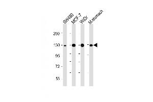 All lanes : Anti-CDH1 at 1:4000 dilution Lane 1: S whole cell lysate Lane 2: MCF-7 whole cell lysate Lane 3: WiDr whole cell lysate Lane 4: Mouse stomach lysate Lysates/proteins at 20 μg per lane. (E-cadherin antibody)