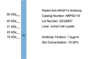 WB Suggested Anti-HRSP12  Antibody Titration: 0. (HRSP12 antibody  (N-Term))
