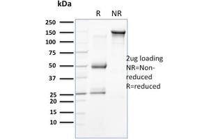 SDS-PAGE Analysis Purified Cytokeratin 15 Mouse Monoclonal Antibody (SPM190). (KRT15 antibody  (C-Term))