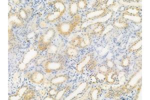ABIN6257352 and ABIN6275243 at 1/100 staining human normal kidney tissue by IHC-P.