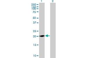 Western Blot analysis of LOC285697 expression in transfected 293T cell line by LOC285697 MaxPab polyclonal antibody. (TAF11L1 antibody  (AA 1-183))