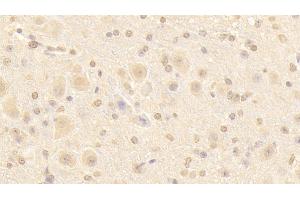 Detection of NUP133 in Mouse Cerebellum Tissue using Polyclonal Antibody to Nucleoporin 133 (NUP133) (NUP133 antibody  (AA 36-240))