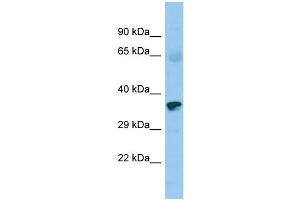 Host: Rabbit Target Name: ZNF330 Sample Type: Fetal Heart lysates Antibody Dilution: 1. (ZNF330 antibody  (C-Term))