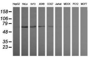 Image no. 2 for anti-Tripartite Motif Containing 38 (TRIM38) (AA 1-265) antibody (ABIN1490688) (TRIM38 antibody  (AA 1-265))