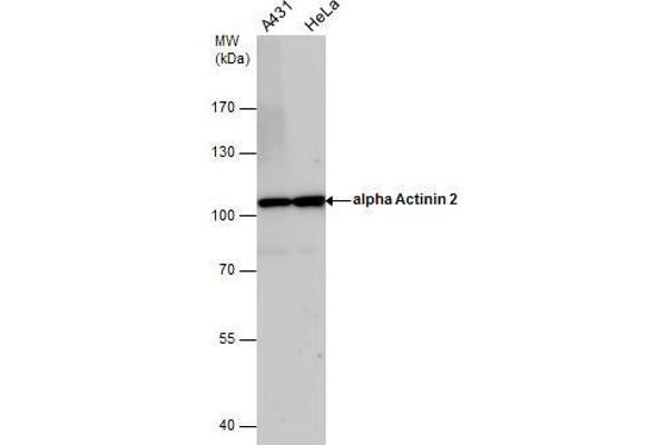 ACTN2 antibody