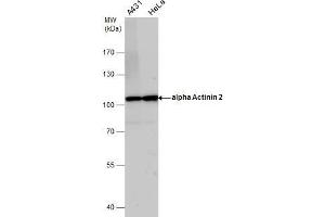 WB Image alpha Actinin 2 antibody detects alpha Actinin 2 protein by western blot analysis. (ACTN2 antibody)