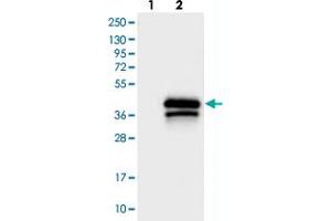 Western blot analysis of Lane 1: Negative control (vector only transfected HEK293T lysate), Lane 2: Over-expression Lysate (Co-expressed with a C-terminal myc-DDK tag (~3. (TREML1 antibody)