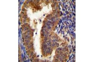 Immunohistochemistry (Paraffin-embedded Sections) (IHC (p)) image for anti-BCL2/adenovirus E1B 19kDa Interacting Protein 3-Like (BNIP3L) (AA 59-89), (Middle Region) antibody (ABIN950671)
