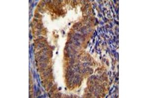 Immunohistochemistry analysis in formalin fixed and paraffin embedded human uterus tissue reacted with BNIP3L / BNIP3A Antibody (Center) followed which was followed by peroxidase conjugated to the secondary antibody and DAB staining. (BNIP3L/NIX antibody  (Middle Region))