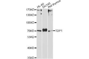 Western blot analysis of extracts of various cell lines, using TDP1 Antibody (ABIN5972797) at 1/1000 dilution. (TDP1 antibody)