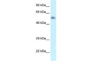 WB Suggested Anti-Zfp472 Antibody   Titration: 1. (Zfp472 antibody  (N-Term))