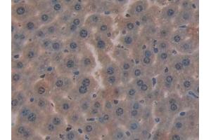 Detection of CYR61 in Mouse Liver Tissue using Polyclonal Antibody to Cysteine Rich Protein, Angiogenic Inducer 61 (CYR61) (CYR61 antibody  (AA 176-379))