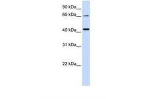 Image no. 1 for anti-Glutaminyl-Peptide Cyclotransferase-Like (QPCTL) (AA 218-267) antibody (ABIN6738335) (QPCTL antibody  (AA 218-267))