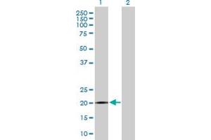 SPANXB1 antibody  (AA 1-103)