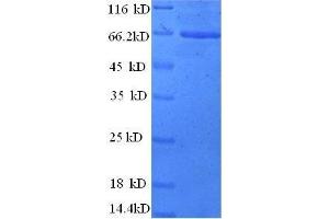 B4GALT3 Protein (AA 34-393) (GST tag)