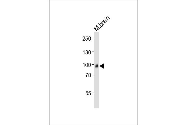 ADAMTS4 antibody  (C-Term)