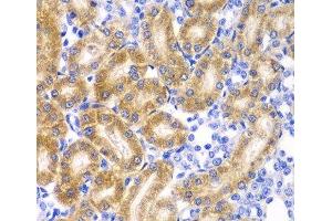 Immunohistochemistry of paraffin-embedded Rat kidney using RPN1 Polyclonal Antibody at dilution of 1:100 (40x lens). (RPN1 antibody)