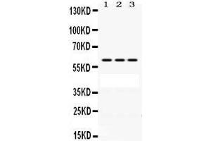 Western Blotting (WB) image for anti-Protection of Telomeres 1 (POT1) (AA 195-234), (N-Term) antibody (ABIN3043444)