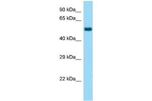 Western Blotting (WB) image for anti-Wolf-Hirschhorn Syndrome Candidate 2 (WHSC2) (C-Term) antibody (ABIN972009) (WHSC2 antibody  (C-Term))