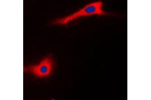Immunofluorescent analysis of CABC1 staining in HeLa cells. (COQ8A antibody  (Center))