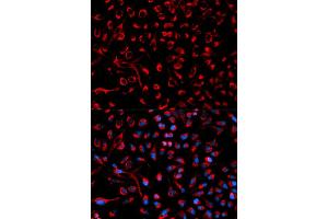 Immunofluorescence analysis of HeLa cells using DOK4 antibody (ABIN1872342). (DOK4 antibody)