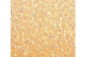 Immunohistochemistry of paraffin-embedded human liver tissue using ABIN7166656 at dilution of 1:100 (LPAL2 antibody  (AA 52-124))