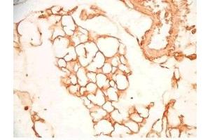 Mouse visceral fat tissue was stained by Rabbit Anti-SFRP-2 S (25-50) (Human) Antiserum (SFRP2 antibody  (AA 25-50))