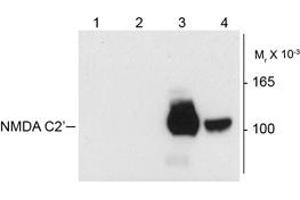 NMDA 1 Receptor Antikörper  (Splice Variant C2')