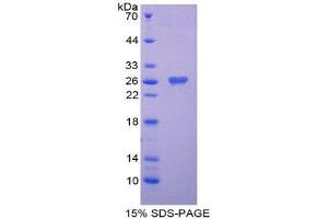 SDS-PAGE (SDS) image for Notch 2 (NOTCH2) (AA 2251-2466) protein (His tag) (ABIN2126124)
