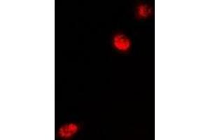 Immunofluorescent analysis of MeCP2 staining in U2OS cells. (MECP2 antibody)