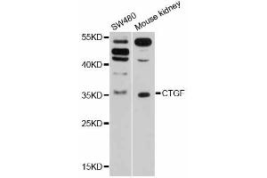 Western blot analysis of extracts of various cell lines, using CTGF antibody (ABIN5997530) at 1/1000 dilution. (CTGF antibody)